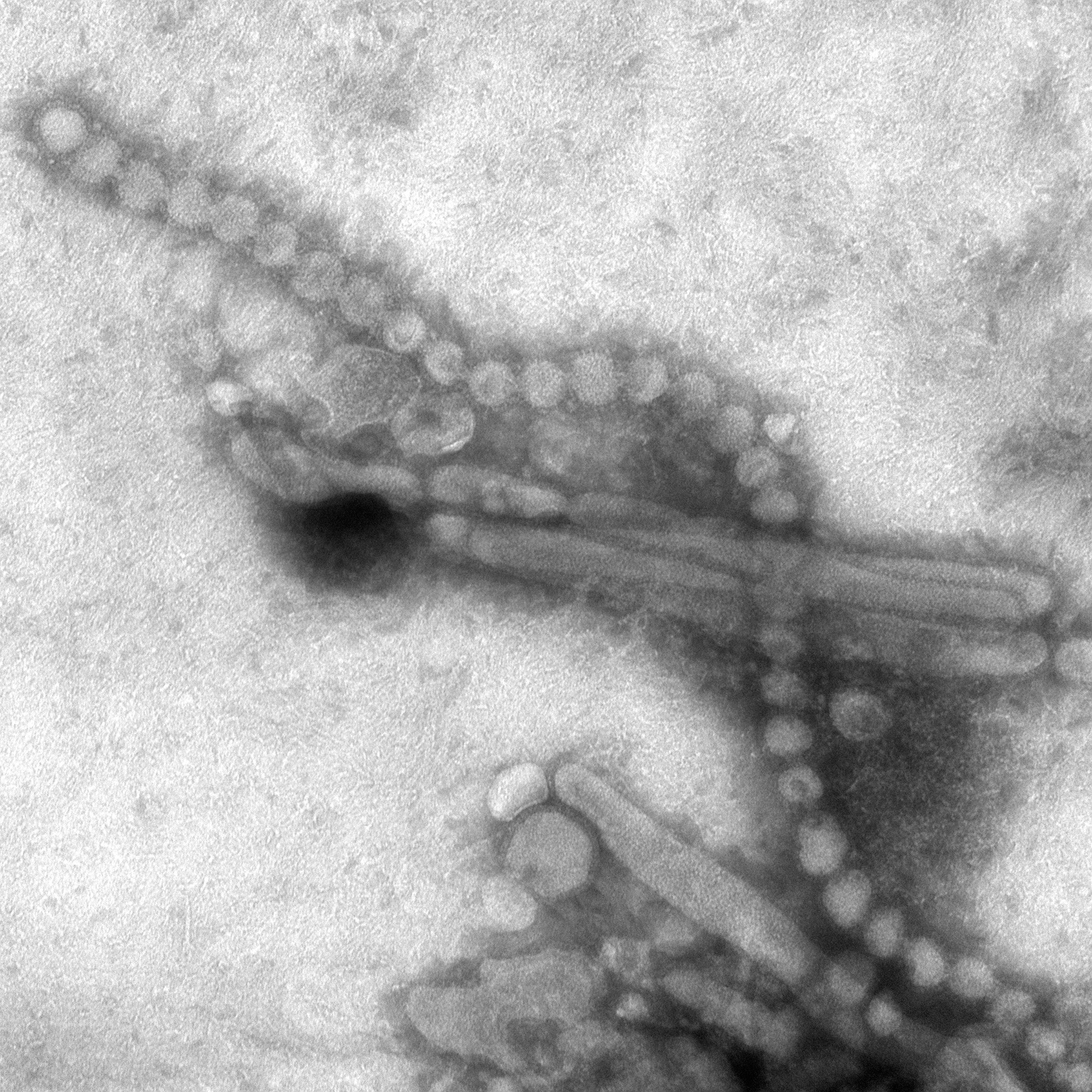 Πιο επιθετικό το νέο στέλεχος του ιού της γρίπης των πτηνών